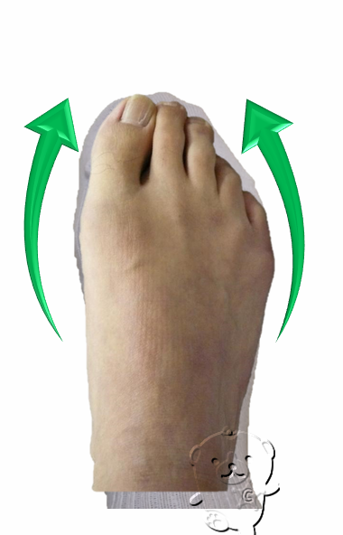 筒状ソックスの中の足指の状態