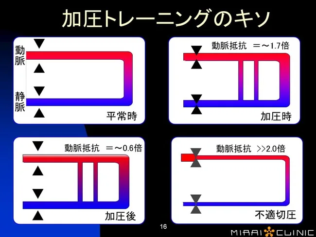加圧トレーニングについて医師が解説 - 福岡のみらいクリニック %