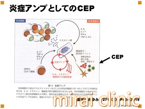LCメカニズム私案