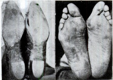 100年以上前の靴の研究からわかった「靴選びの本質」 | 福岡のみらい